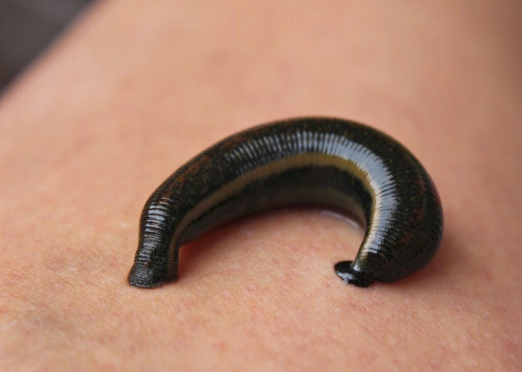 leeches encountered while hiking
